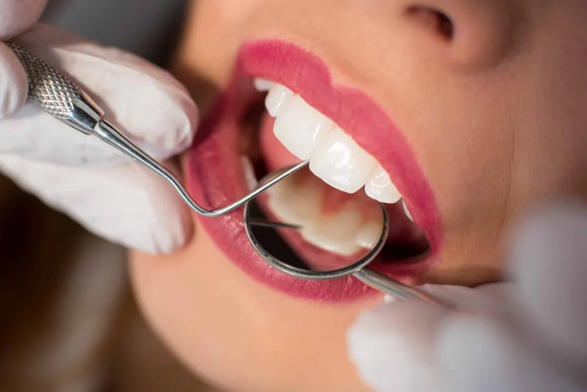 Patient receiving porcelain veneers at a dental clinic in Park City.